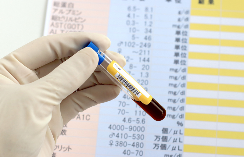 採血方法と安全への配慮