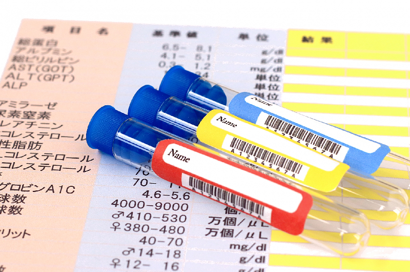 尿検査・便検査とは