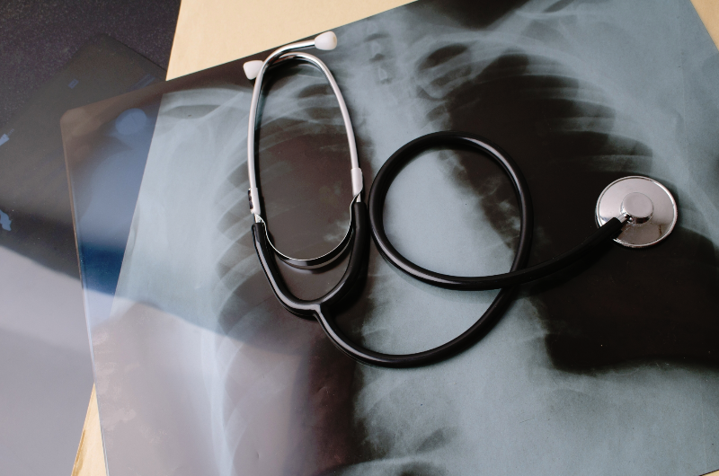 検査の安全性について